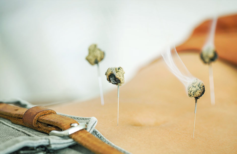 Acupuncture Therapy